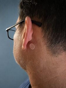 Close-up photo showing the correct placement of a scopolamine motion sickness patch directly behind the ear before scuba diving.